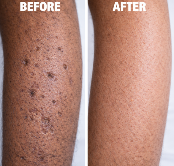 skin